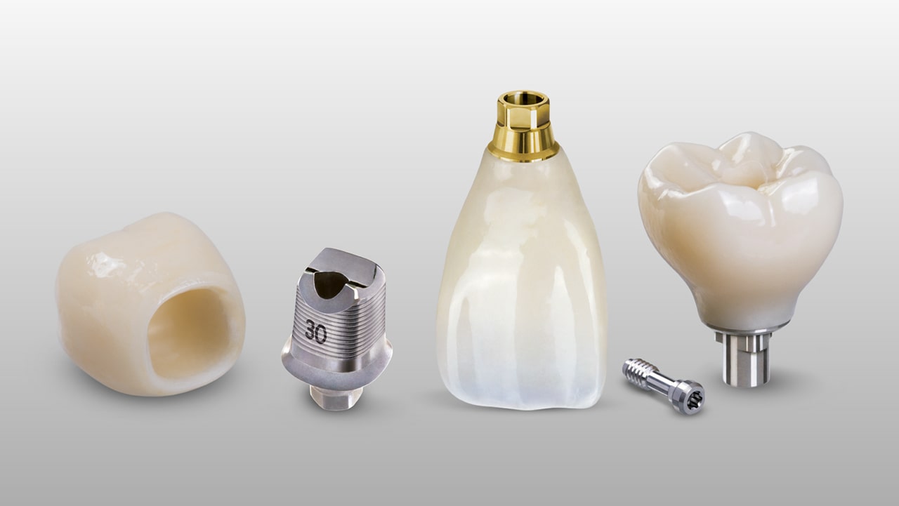 dental lab implant restorations